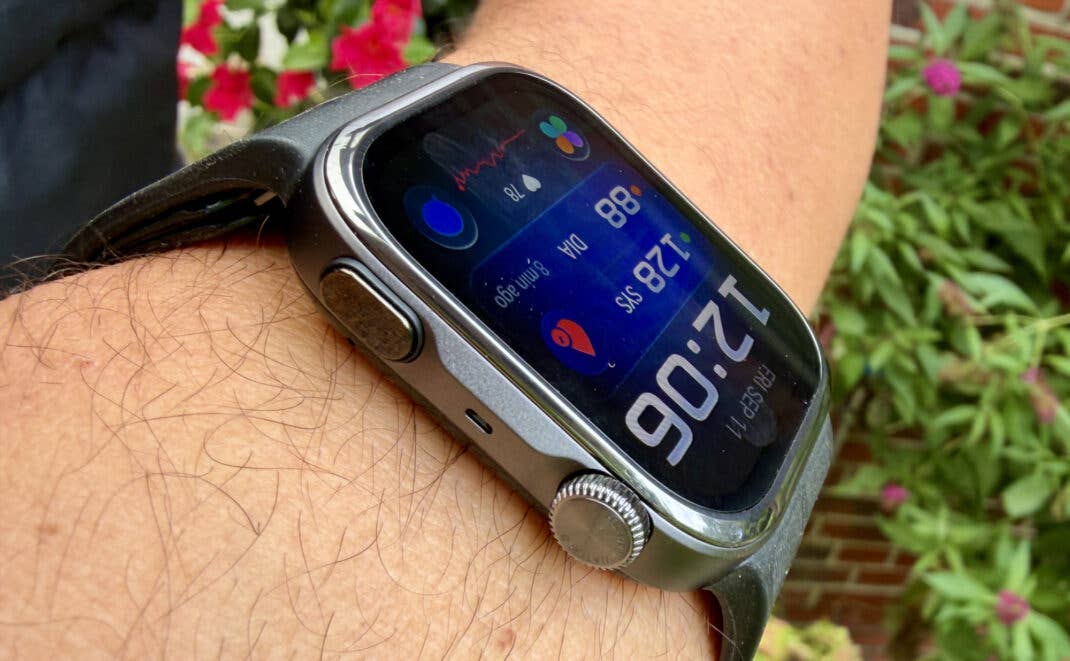 So genau misst die Huawei Watch D3 wirklich deinen Blutdruck